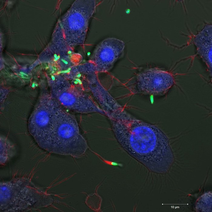 Новые нанокапсулы доставляют антибиотики к инфицированной клетке 