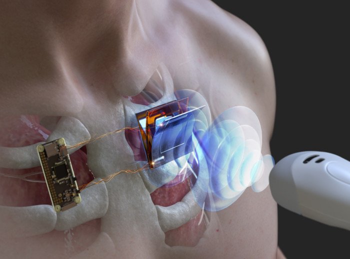 Корейские ученые разработали беспроводную зарядку для электронных имплантатов 