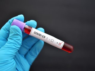 Фото: jarun011 / 123RF