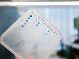 Рост бактерий на индикаторной среде, Сколтех. Фото: Ольга Мерзлякова / «Научная Россия»