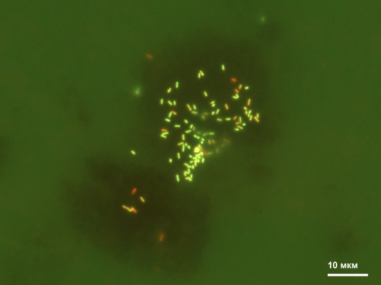 Новый род бактерий Parvivirga в новом порядке Anaerosomatales ранее некультивируемой группы OPB41. Эта бактерия составляет до 7% в микробном сообществе водоносного горизонта, откуда добываются воды типа «Ессентуки № 4». Клетки окрашены флуоресцентным красителем акридиновым оранжевым и расположены на частицах гидроксида окисного железа (минерал ферригидрит). Это анаэробная, термофильная, узкоспециализированная бактерия, которая восстанавливает только растворимые или нерастворимые соединения железа, используя в качестве субстрата водород или натриевую соль муравьиной кислоты. Фото: ФИЦ Биотехнологии РАН