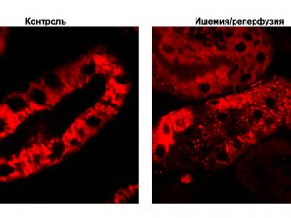 Фрагментация митохондриального ретикулума после ишемии/реперфузии почки // Источник: Егор Плотников/МГУ