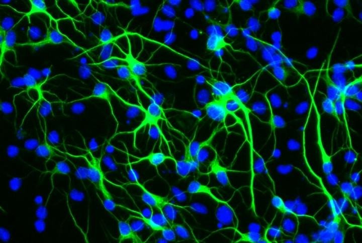 Исследование показывает, как ген долголетия защищает стволовые клетки мозга от стресса