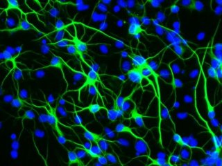 Исследование показывает, как ген долголетия защищает стволовые клетки мозга от стресса