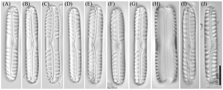 Один из новых описанных видов диатомовых водорослей — Pinnularia paradubitabilis. Микрофотография сделана с помощью светового микроскопа. Источник: Kezlya et al. / Cells, 2022