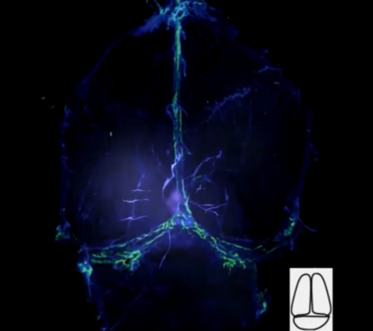 Зеленым цветом выделены окрашенные лимфатические сосуды в мозге мыши. Источник фото: скриншот выступления О.В. Семячкиной-Глушковской / Око Хокинга. Оригинал статьи: Structural and functional features of central nervous system lymphatic vessels / Nature