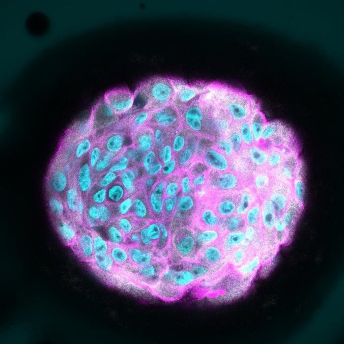 Обнаружен белок, защищающий клетки от роста опухоли молочной железы