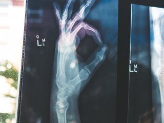 Будущее уже здесь: искусственный интеллект и медицинские снимки. Источник:  Owen Beard / Фотобанк Unsplash 
