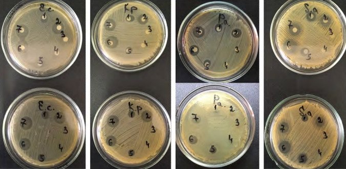 Фото чашек с результатами одного из экспериментов по определению антибактериального действия растворов. Источник: пресс-служба ПНИПУ