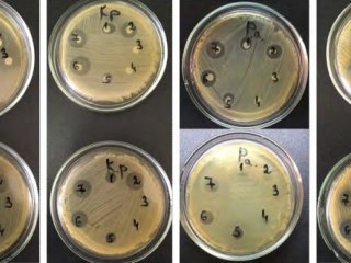 Фото чашек с результатами одного из экспериментов по определению антибактериального действия растворов. Источник - пресс-служба ПНИПУ