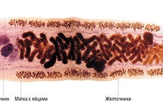 Opisthorchis felineus. Фото В. Гуляева