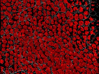 Исследование на мышах показывает, как болевые нейроны защищают кишечник от повреждений