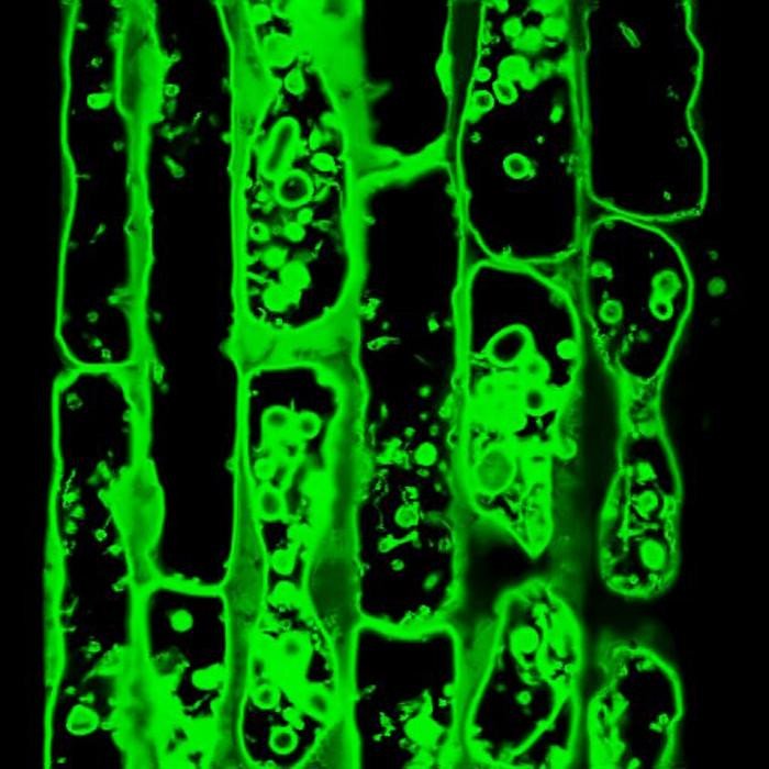 Конфокальная микрофотография корневых клеток Arabidopsis thaliana, демонстрирующая перемещение GFP-ATG8 в тонопласт при повреждении клеточной стенки. Фото: José Julian / GMI