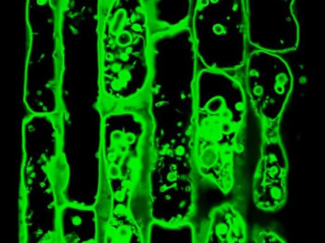 Конфокальная микрофотография корневых клеток Arabidopsis thaliana, демонстрирующая перемещение GFP-ATG8 в тонопласт при повреждении клеточной стенки. Фото: José Julian / GMI