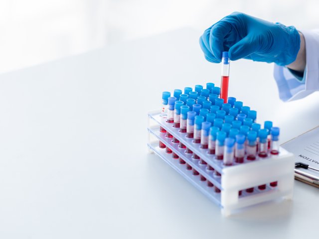 Источник фото: dookdui / ru.123rf.com