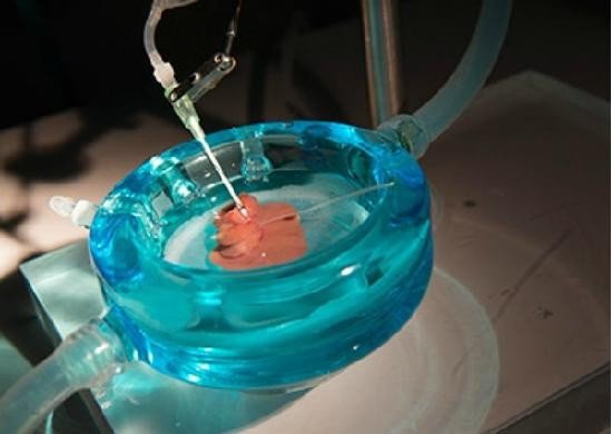 Разработан новый метод хранения пересаживаемых органов