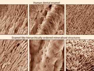 Ученые разрабатывают новые минерализованные материалы, которые могут восстанавливать зубную эмаль