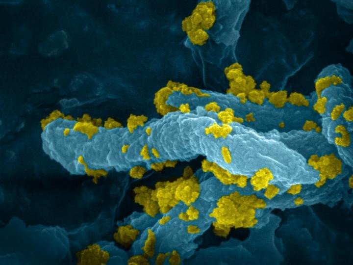 Ученые используют бактерии для производства водорода