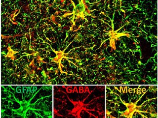 Обнаружен нейротрансмиттер, вызывающий болезнь Альцгеймера