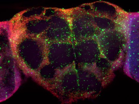 Нейроны и глия вместе помогают восстановить нервные клетки 