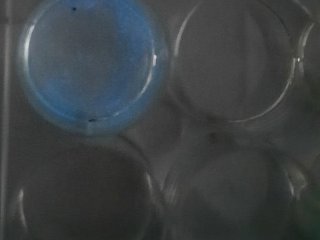 Новый метод оценки эффективности онкотерапии разработали ученые из ИМКБ СО РАН и НГУ. Фото: Сергей Кулемзин, Татьяна Беловежец / НГУ 