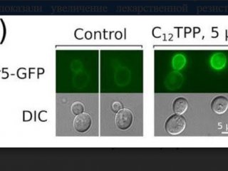 Клетки дрожжей, нарабатывающие химерный белок Pdr5-GFP, под флуоресцентным микроскопом/Galkina, K.V., Besedina, E.G., Zinovkin, R.A. et al. Penetrating cations induce pleiotropic drug resistance in yeast. Sci Rep 8, 8131 (2018).