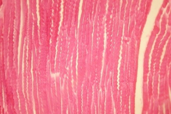 Срез мышцы после облучения на CO2-лазере, оптическая микроскопия. Волокна скручиваются в спирали. Автор фото - Александр Козлов