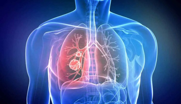 Ученые из Томска создали газоанализатор для диагностики новообразований дыхательных путей