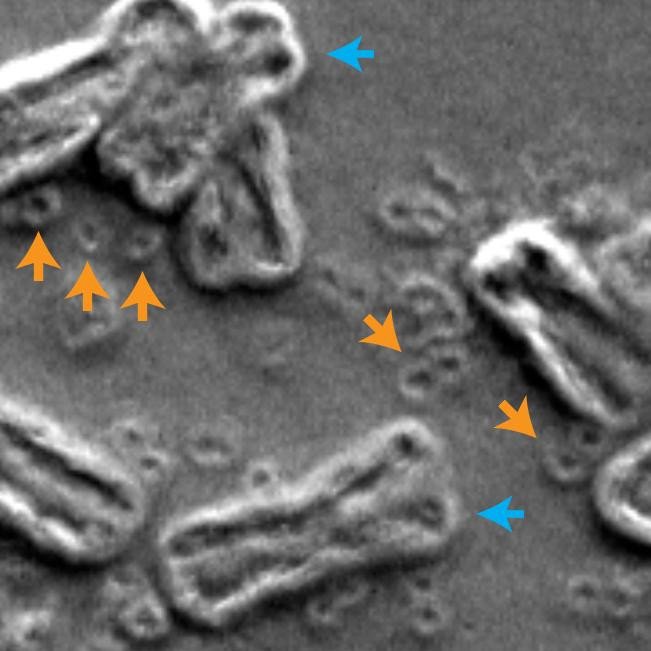 Разрушенные хромосомы делают раковые клетки устойчивыми к лекарствам