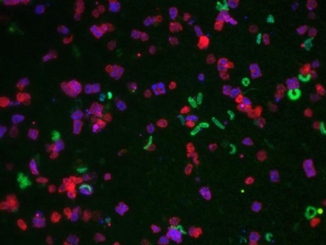 Клетки Salinibacter ruber (зеленые) под микроскопом. Другие цвета обозначают различные организмы в солончаке. Фото: Tomeu Viver / Georgia Institute of Technology