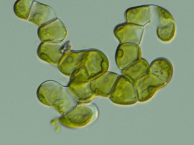 Изображение, демонстрирующее разветвлённые нити водоросли Coleochaete — загадочной группы, которая в ходе эволюции приобрела более сложные дискообразные тела. Фото: Tatyana Darienko / University of Göttingen