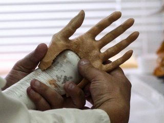 В Новосибирске разработали дешевый робопротез руки