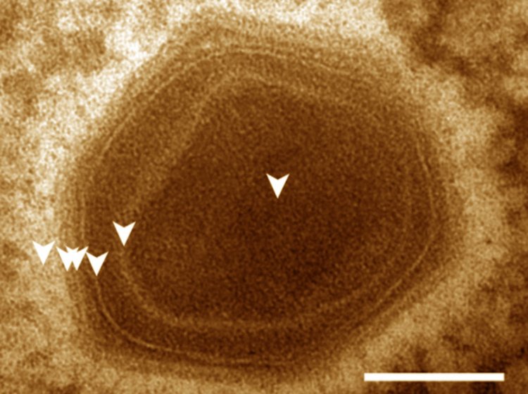Ученые обнаружили гигантский вирус, заражающий микрозоопланктон