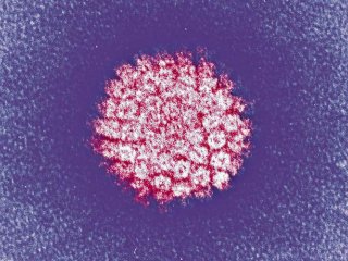 Тест на вирус папилломы человека лучше диагностирует рак шейки матки, чем ПАП-тест