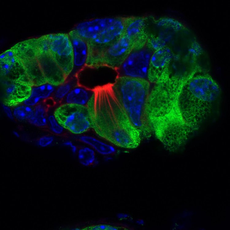 У мышей при панкреатите образуются специальные «пучковые» клетки