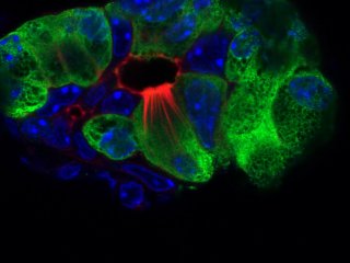 У мышей при панкреатите образуются специальные «пучковые» клетки