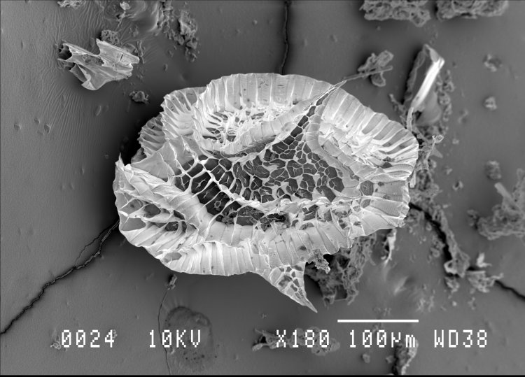 Это не чудовище, а тоже представитель ветвистоусых ракообразных – Chydorus bicornutus, фотография выполнена при помощи сканирующего электронного микроскопа