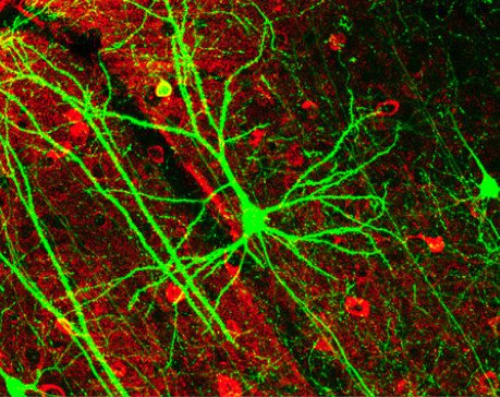 Пирамидный нейрон коры головного мозга мыши, экспрессирующий зелёный флуоресцентный белок (GFP)