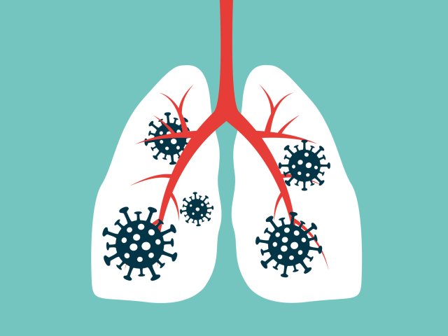 Разработан способ диагностики смертельно опасных лёгочных инфекций. Фото: ru.123rf.com
