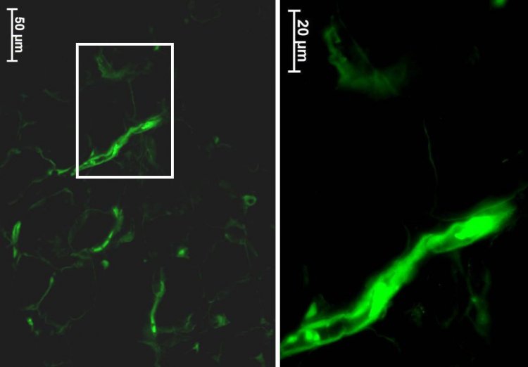 Светящиеся мелкие сосуды в жировой ткани пахового лимфоузла животного через неделю после ложной операции. Фото предоставлено Игорем Майбородиным