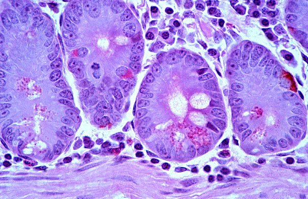Определена решающая роль клеток Панета в здоровье кишечника