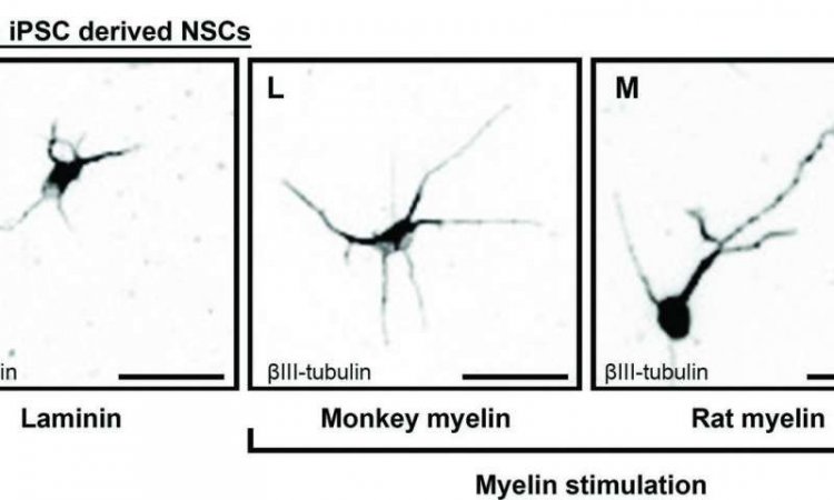 Миелин стимулирует рост нейронов при травмах спинного мозга