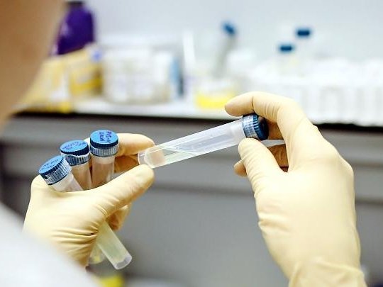 Новый тест покажет уровень заразности и тяжесть коронавируса у пациента