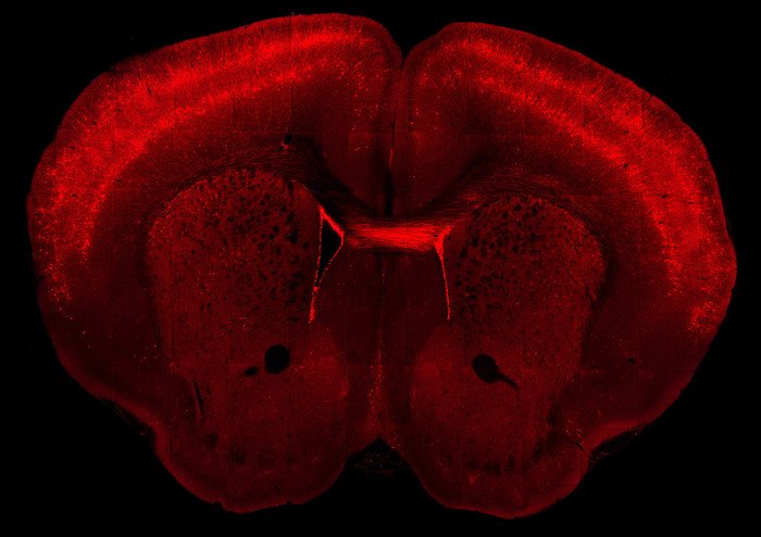 Нейробиологи составили первый атлас клеток моторной коры мозга 