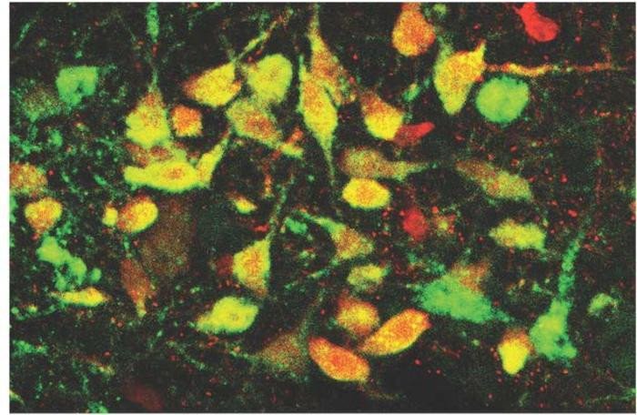 Изображение дорсальной рапы, области, расположенной в стволе мозга, показывает серотонинергические нейроны зеленым цветом, вирусно экспрессированный белок TdTomato - красным, а колокализованные клетки - желтым. Лаборатория Спитцера