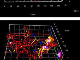 На изображении показаны двигательные нейроны, полученные из индуцированных плюрипотентных стволовых клеток человека (iPSC) и интегрированные в биоматрицу, напечатанную методом 3D-печати. Фото: Elena Kozlova / Uppsala University