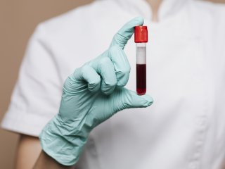 Разработан инструмент ранней диагностики болезни Альцгеймера. Фото: rawpixel.com / Freepik