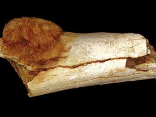 Наши предки страдали раком еще 1,7 млн лет назад