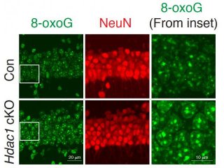 Найден фермент против старения нейронов у мышей