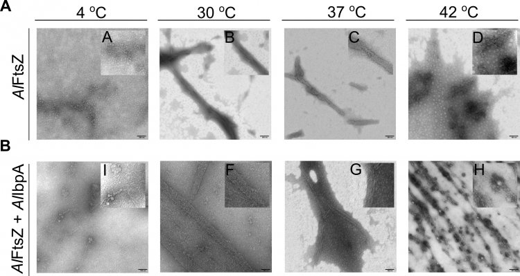 Набор микрофотографий, иллюстрирующих эффект взаимодействия малого белка теплового шока IbpA и белка деления FtsZ при разных температурных условиях